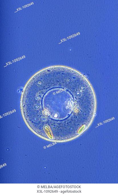 Arcella sp Amoeba Rhizopoda Protozoans Optic microscopy