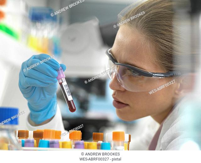 Health Screening, Scientist holding a tube containing a blood sample ready for analysis in the laboratory