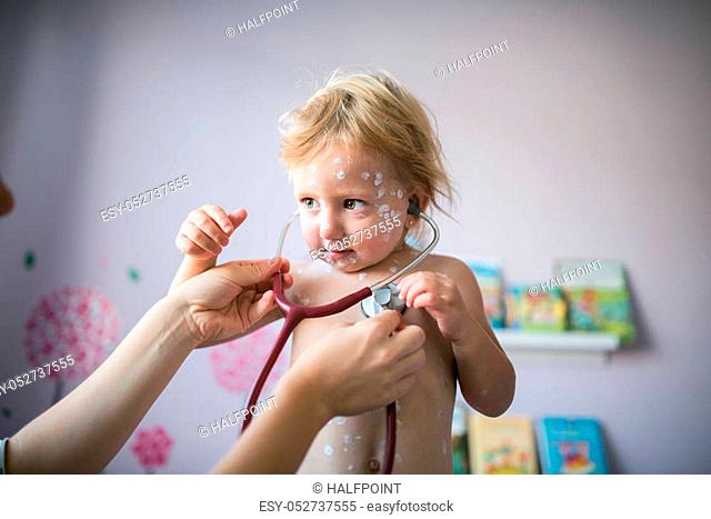 Little two year old girl at home sick with chickenpox, white antiseptic cream applied to the rash. Mother giving her stethoscope
