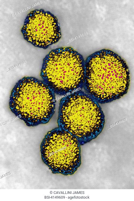 HCV - Hepatitis C virus. Single-stranded RNA virus in a nucleocapsid. Image HDRI made according to a view under transmission electron microscope