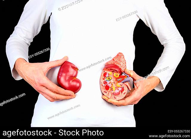 Female hands hold model of human kidney organ in front of white body at black