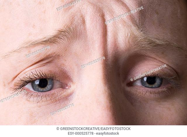 a closeup of a young woman's wrinkled brow