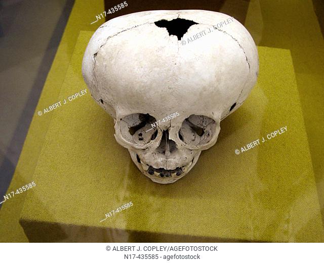 Maya human skull intentionally deformed during childhood in museum, Mérida. Yucatán, Mexico