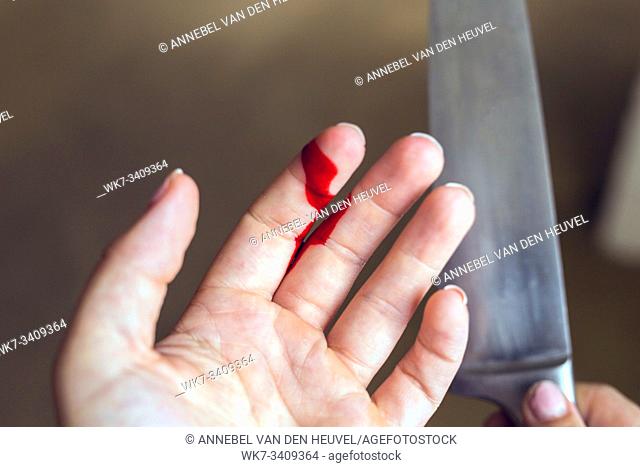 Finger cut, bleeding injured with knife, Flesh blood wound in hand close-up