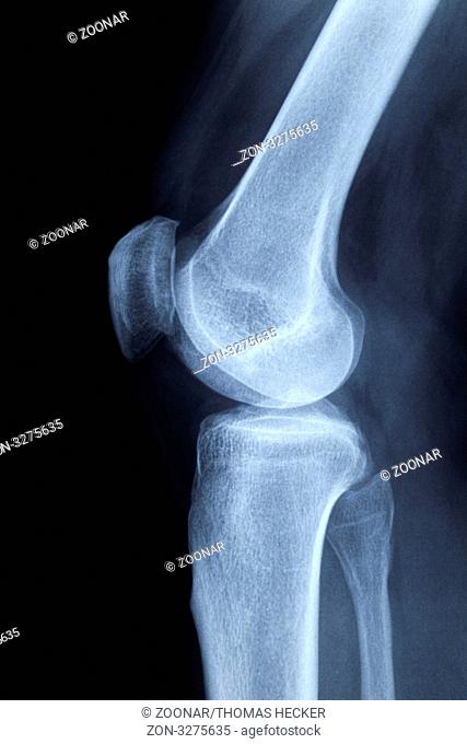 linkes, menschliches Knie seitlich, Röntgenaufnahme ohne Befund, blaue Tönung / left human knee lateral, x-ray image without findings, blue tint