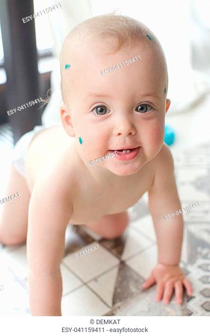 Shot of adorable baby with green spots on face bed and looking at camera on a floor at home