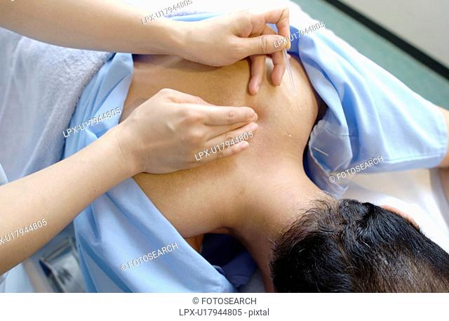 Young woman putting acupuncture needles on man's shoulders, close up