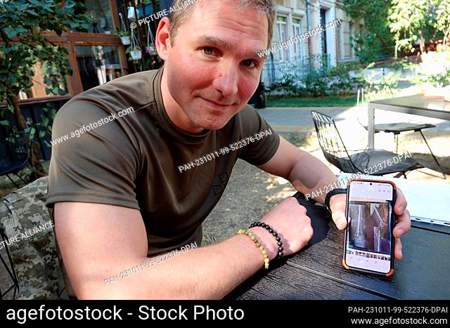 PRODUCTION - 29 September 2023, Ukraine, Kiew: Wounded Ukrainian soldier Dmytro Ushchenko shows on his cell phone a picture of the metal splint in his thigh
