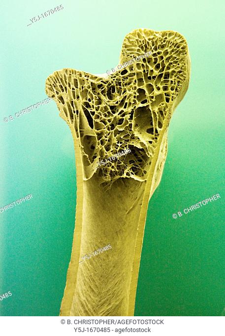 Cross section of human long bone showing trabecula bone tissue