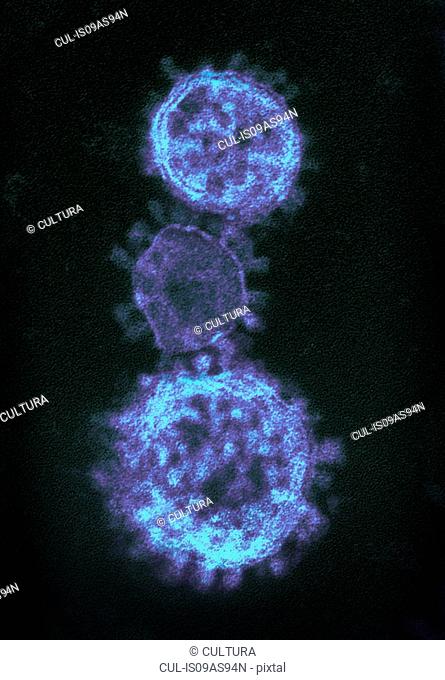 Colorized transmission electron micrograph (TEM) showing three spherical-shaped Middle East Respiratory Syndrome Coronavirus (MERS-CoV) virions