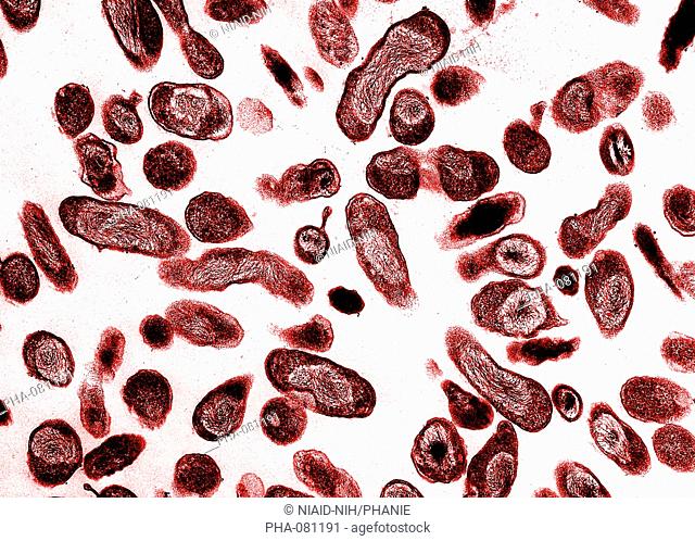 Colored transmission electron micrograph TEM of Coxiella burnetii, a bacterium responsible for Q fever. Q fever is a disease present in livestock that can be...