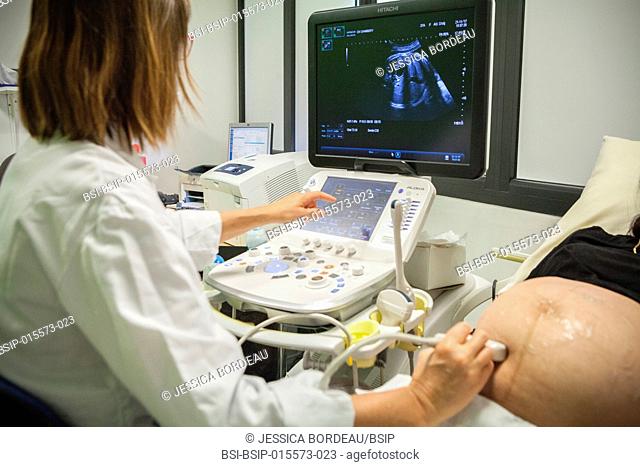 Reportage in the maternity clinic in Chambéry, France. A monitoring scan a few days before the due date
