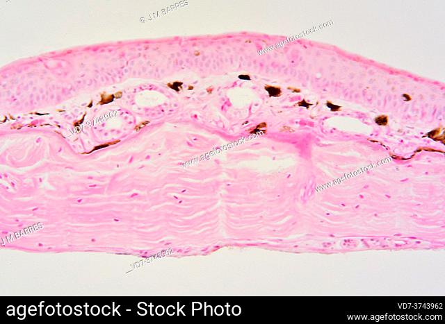 Frog skin showing epidermis, pigmentary layer with melanocytes (brown), blood vessels and dermis. Photomicrograph X150 at 10 cm wide