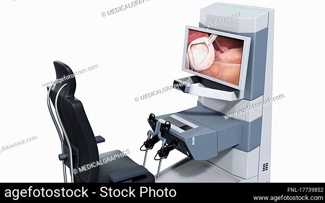Illustration of the control unit (cockpit) of a surgical robot for use in laparoscopic procedures. The surgeon controls the camera inside the patient's abdomen...