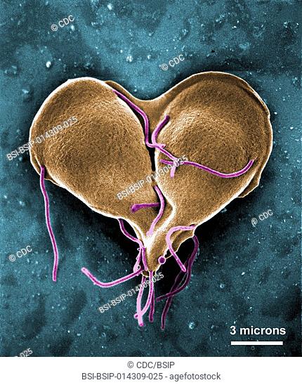 This digitally-colorized scanning electron micrograph (SEM) depicted a Giardia lamblia protozoan that was about to become two, separate organisms