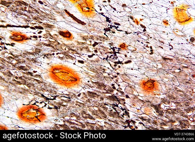 Epithelium simple squamous. Photomicrograph X150 at 10 cm wide
