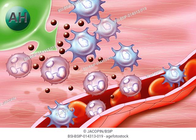 illustration of the stimulation of an immune reaction by hyaluronic acid in order to clean a wound