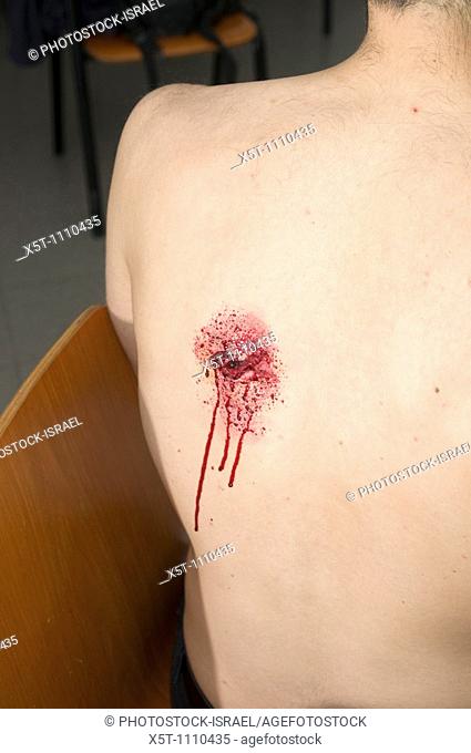 Mock up injury of a gun shot wound  The exit wound in the victim's back Injury created with make up  Model Release available