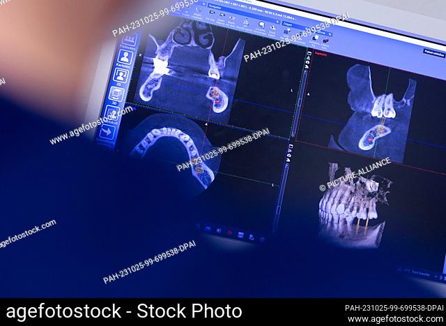 23 October 2023, North Rhine-Westphalia, Mönchengladbach: X-rays of a patient are viewed on a computer in Dr. Kranz's dental office