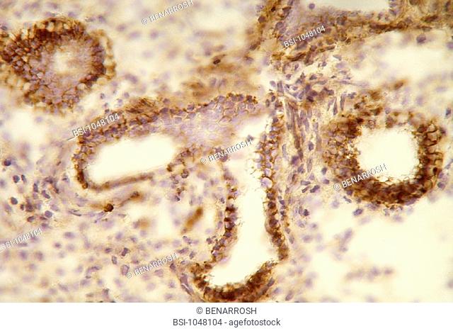 FETAL LUNG,  HISTOLOGY<BR>Histological section of a human fetal lung at the stage of 14 weeks of gestation.  Staining with an anti CD44 antibody, in brown