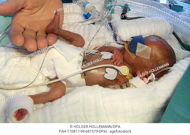 The right foot of a 5-day-old boy who weighed 430 grams at birth, in the hand of a nurse, at the children's clinic of Hannover Medical School (Medizinische...