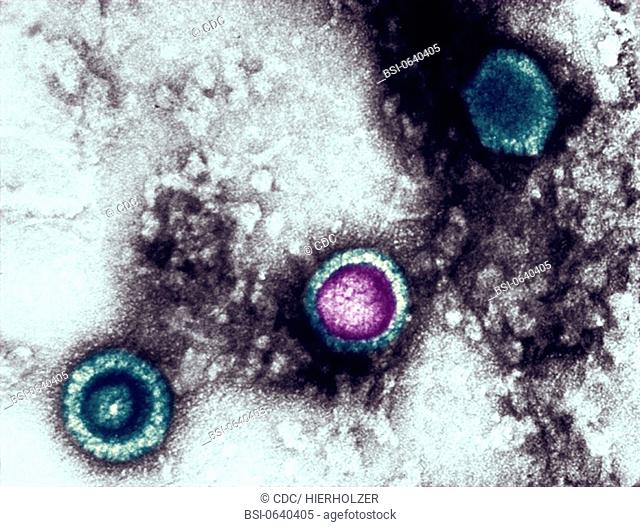 HERPES VIRUS<BR>This transmission electron micrograph from a pelleted specimen depicts three icosahedral-shaped herpes virus virions