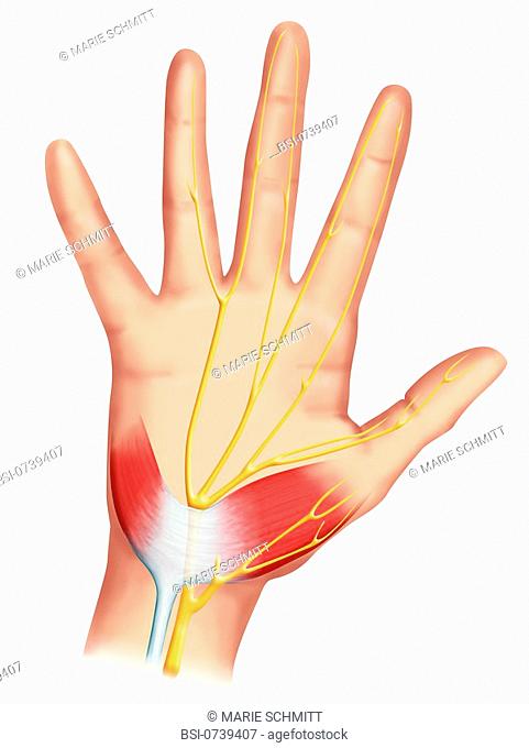 Carpal tunnel. On the palmar face of the wrist we can observe an anatomical tunnel called carpal tunnel. The tendons and the median nerve slip throught this...