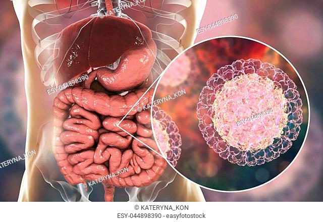 Rotaviruses in small intestine, 3D illustration. Rotaviruses are RNA viruses the causative agent of diarrheal disease in children