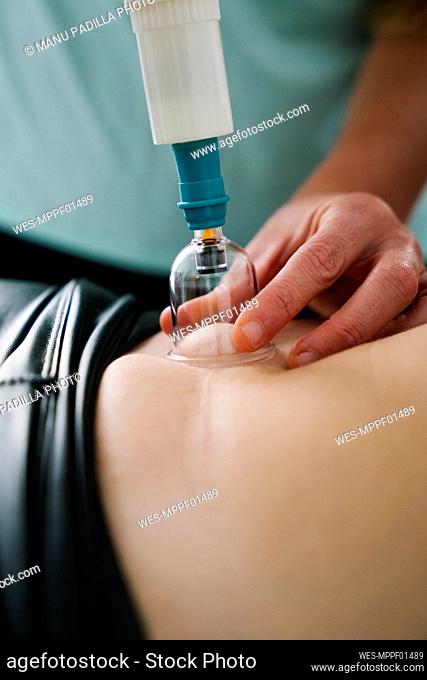MIdwife vacuum cupping on patient's abdomen