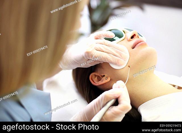 Laser mole removal on a woman's neck in a beauty salon. Close up