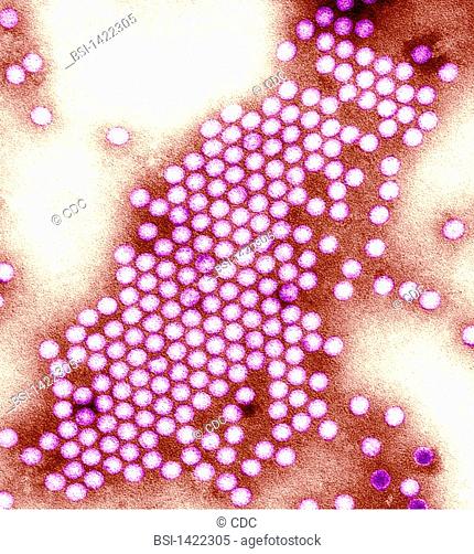 POLIOMYELITIS VIRUS<BR>Poliovirus.<BR>Transmission electron micrograph, negative stain image of the polio virus