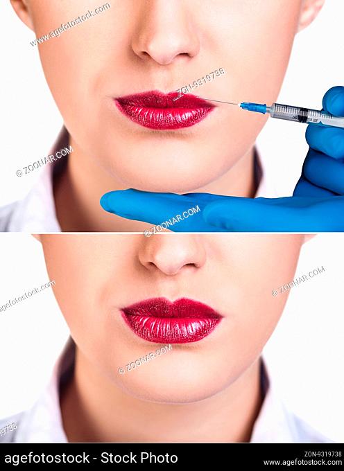 Closeup of beautiful woman gets injection in her lips. Isolated over white background