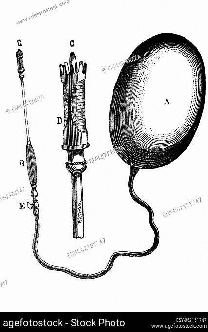 Cauterizer. Antique illustration from a medical book, 1889