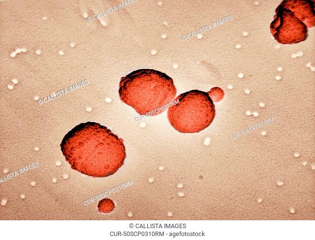 Electron micrograph of Streptococcus pneumoniae