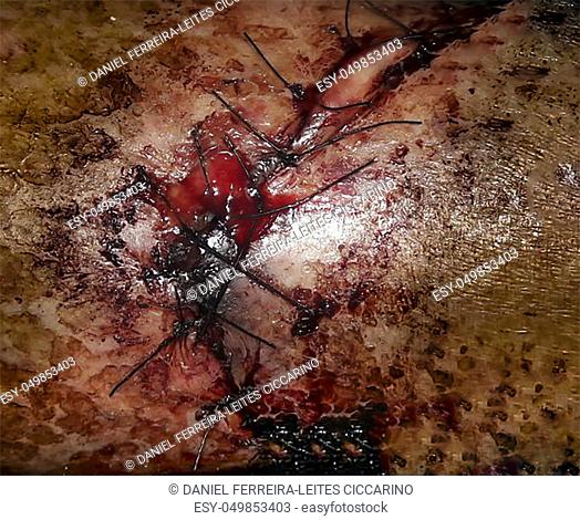 Closeup view sutured wound photo in dark colors