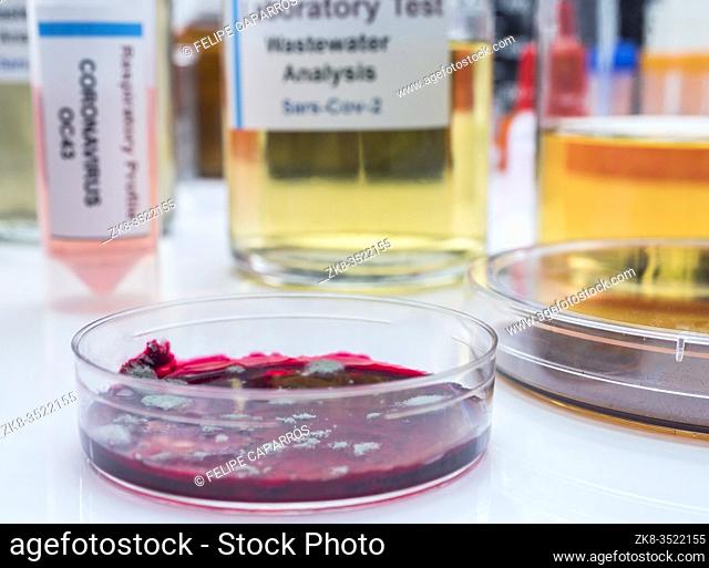 Bacteriological petri-disk culture with wastewater samples, analysis of sars-cov-2 virus in patients infected by human coronavirus 229E, conceptual image