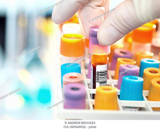 Laboratory technician preparing blood sample for medical testing in laboratory