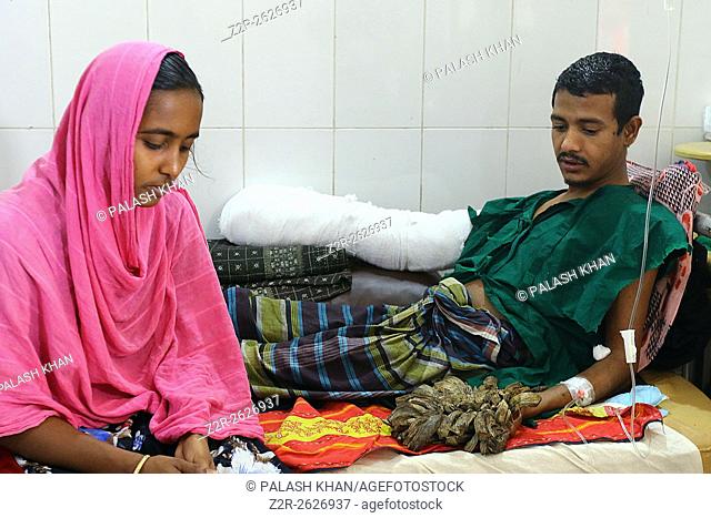 Bangladeshi man rests after a surgery at Dhaka Medical College Hospital in Dhaka on Feb. 23, 2016. A Bangladeshi man dubbed tree man due to large bark-like...