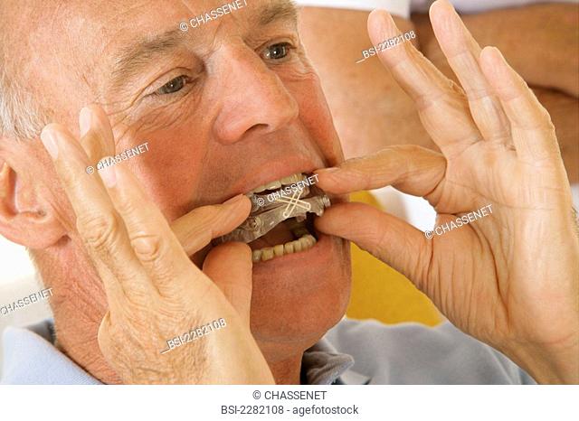 Models. Mandibular advancement device proposed to a patient to treat snoring and/or sleep apnea