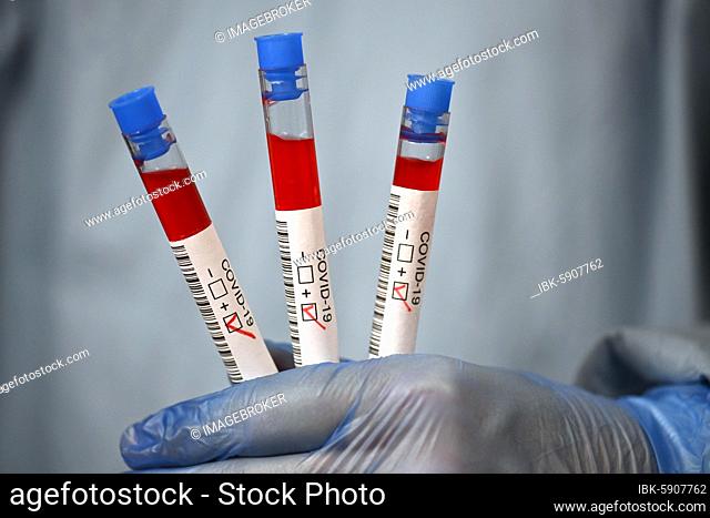 Positive test result, medical personnel using RT-PCR, real-time reverse transcriptase polymerase chain reaction, corona test, corona crisis, Baden-Württemberg
