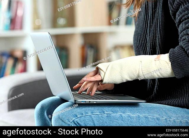 Close up of a disabled woman with bandaged arm using laptop at home