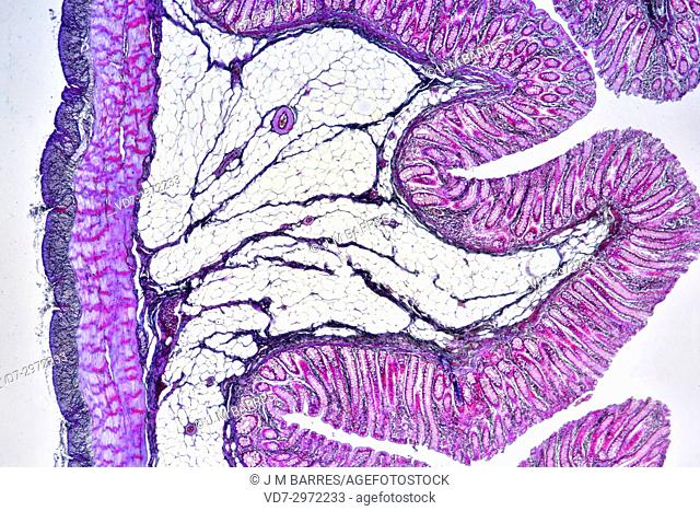 Human colon showing epithelium, mucosa, submucosa, muscular layer, adipose tissue, serosa, intestinal glands, villi and vessels