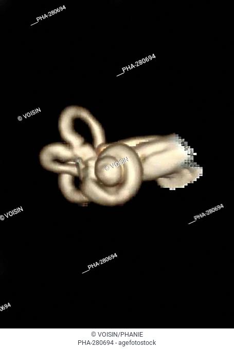 Axial section of membranous labyrinth of the inner ear, it is composed of the utricle, saccule, semi-circular canals and the endolymphatic sac and channel...