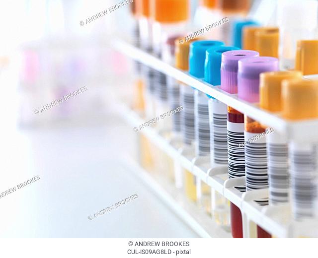 A row of human samples for analytical testing including blood, urine, chemistry, proteins, anticoagulants and HIV in lab