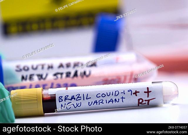 Several vials of blood samples positive for covid-19 infection of the new variant in the Brazil, conceptual image