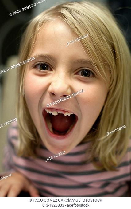Girl showing his broken tooth