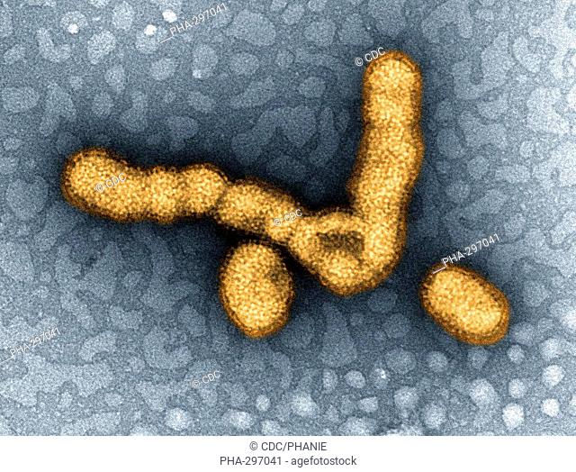 Transmission Electron Micrograph (TEM) depicts numbers of H1N1 influenza virus particles