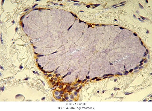 BRONCHUS, HISTOLOGY<BR>Histological section of a normal human adult bronchi. Staining with an anti cytokeratin 19 antibody, in brown
