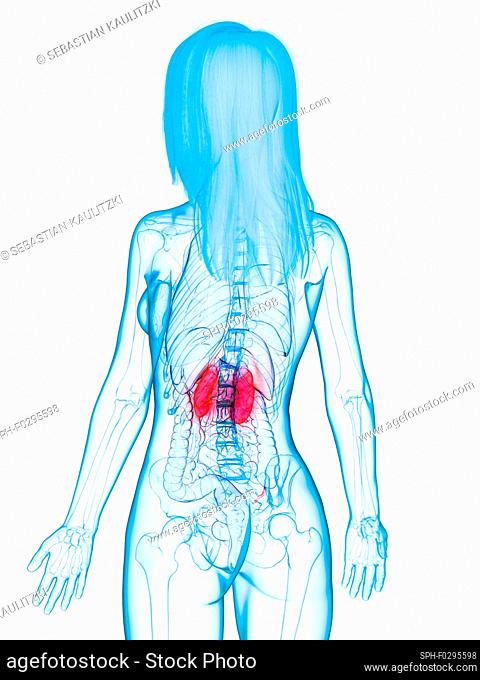 Diseased kidneys, illustration