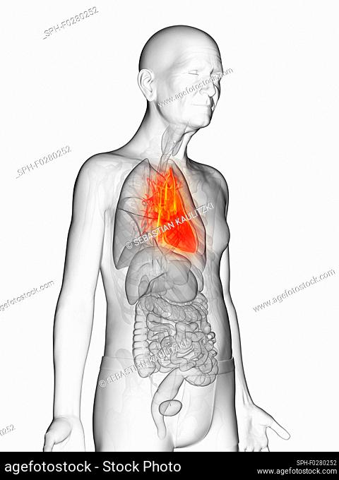 Illustration of an elderly man's heart